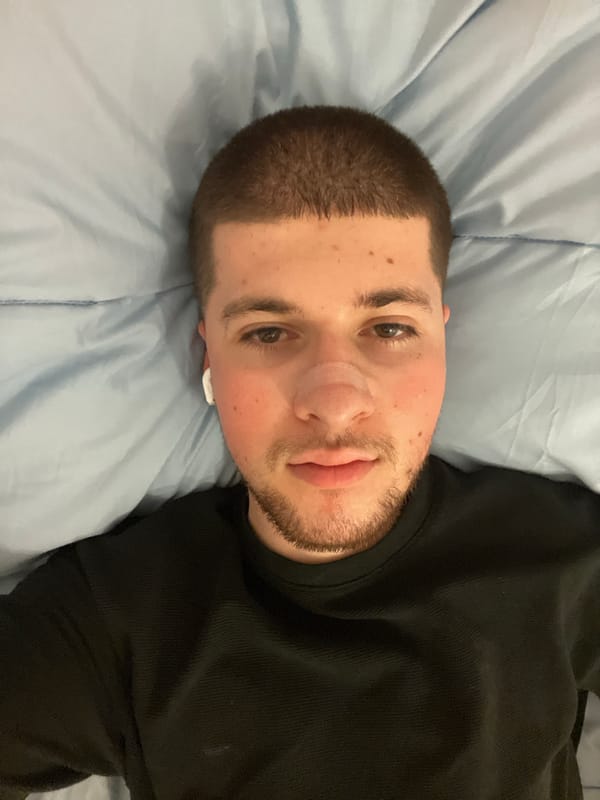 Man with nose bandage rests indoors in Varna