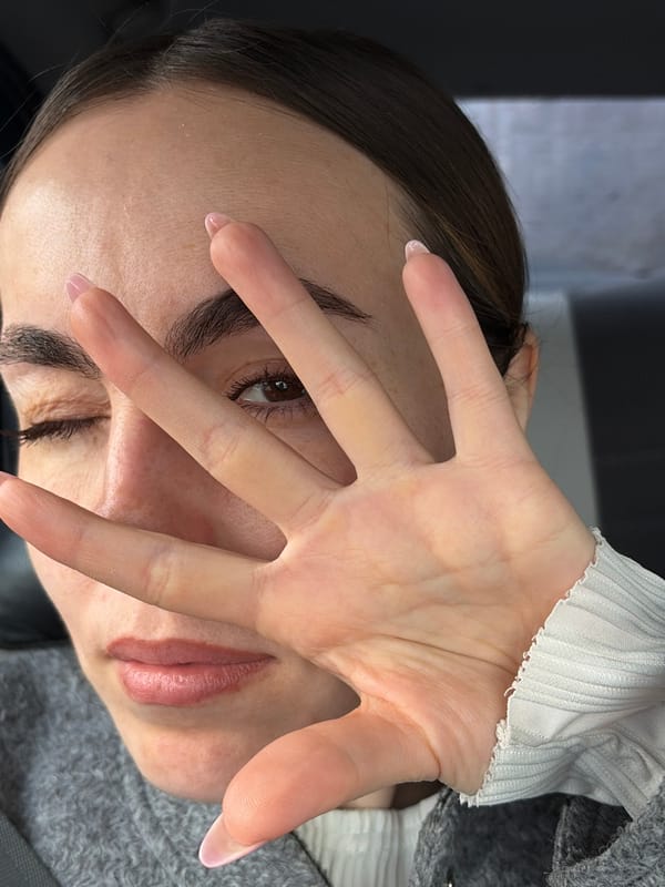 Woman photographed with hand covering face in Izhevsk