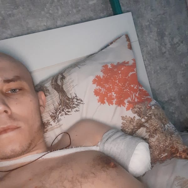 Injured man rests indoors with bandaged arm