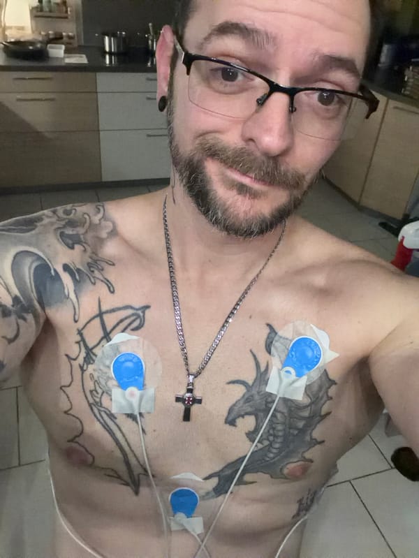 Man with EKG sensors observed in German kitchen