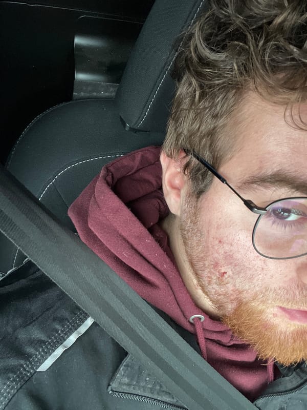 Person rests in car seat during journey in Pernik