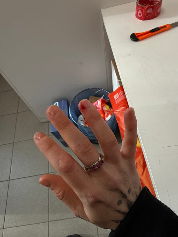 Minor finger injury documented in Saint Petersburg workspace