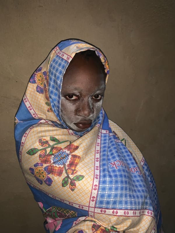 Woman receives facial mask treatment in Agban, Nigeria