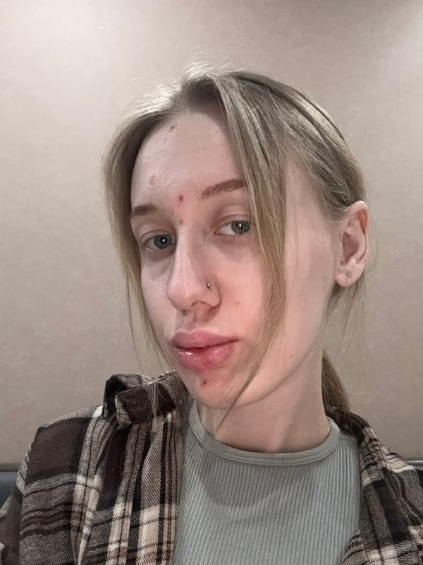 Woman and corgi photographed moments apart in Novoalexandrovka