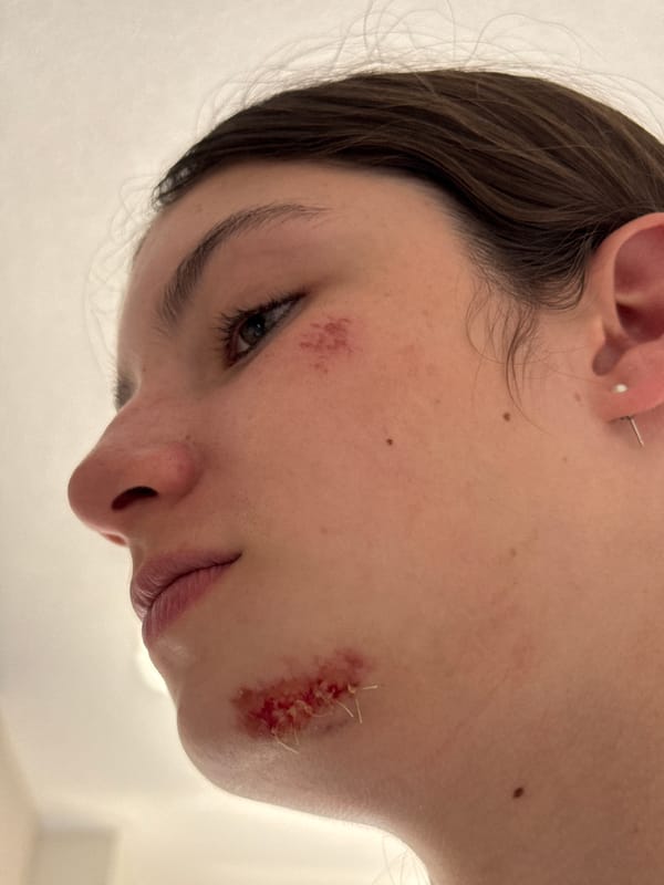 Facial injuries documented in Vancouver witness account