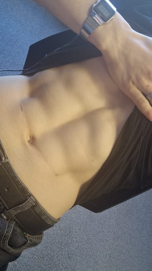 Person Shows Abdomen With Visible Scar Near Navel