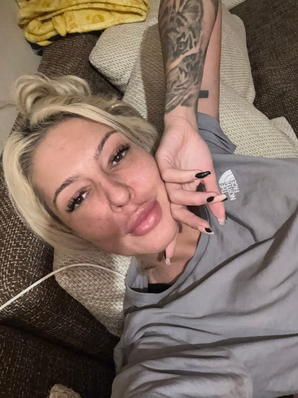 Woman with swollen lips photographed on couch in Plovdiv