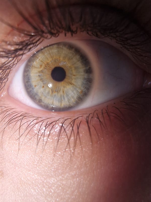 Close-up eye documentation recorded in early morning hours