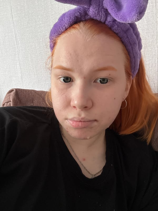 Red-haired person in bunny headband photographed in multiple poses