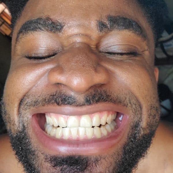 Man smiling, black sports car documented in urban setting
