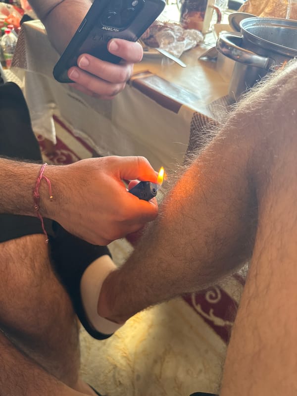 Person lights leg hair with flame in Bulgarian indoor incident