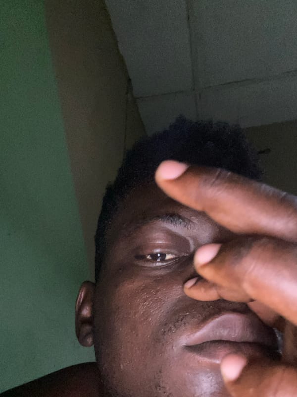 Person covers face with hand in close-up photograph