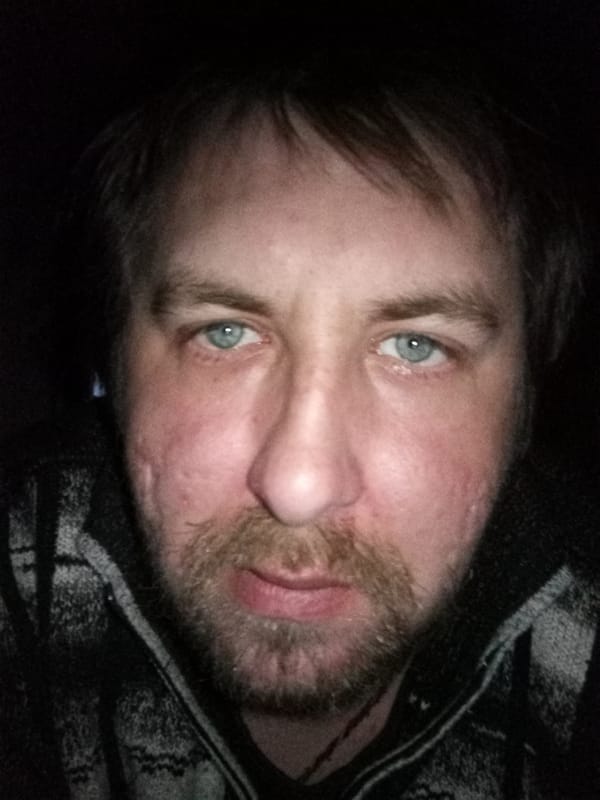 Close-up portrait of middle-aged man with facial scarring documented