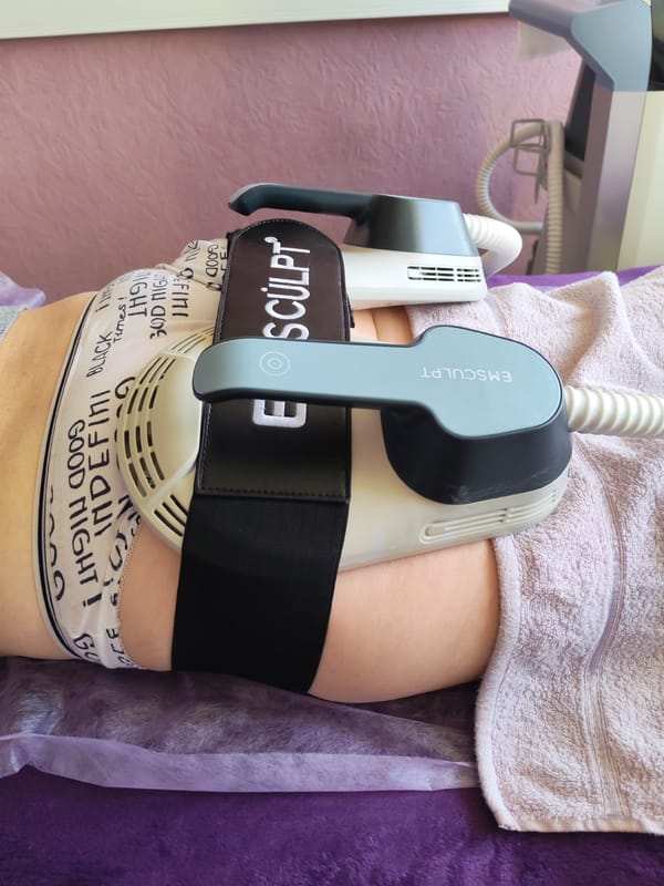 Daily life moments captured across Chaikovsky, Russia morning