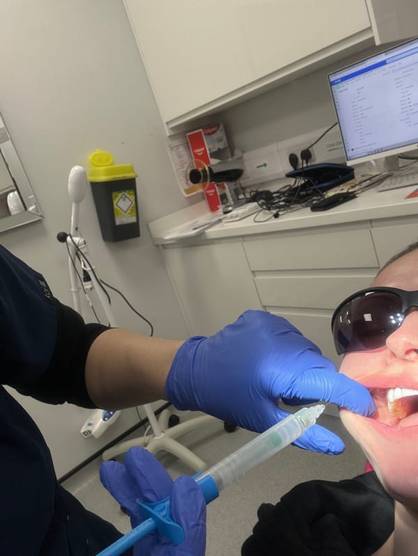 Dental procedure with digital modeling documented in Tunbridge Wells