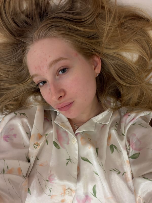 Woman photographed resting in white pajamas in Rossiyskiy