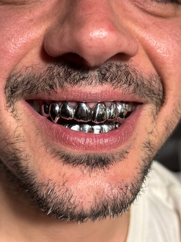 Man with silver grills photographed in Sofia indoor setting
