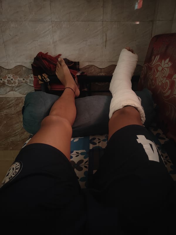 Person recuperates with elevated leg cast in Mumbai