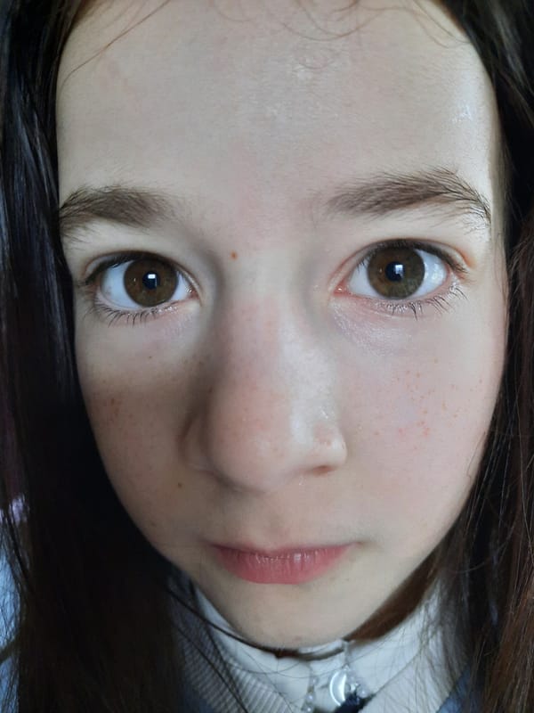 Portrait of young person with freckles documented