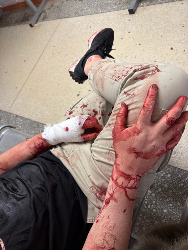 Injured person with bandaged hand observed in Ust-Ilimsk, Russia