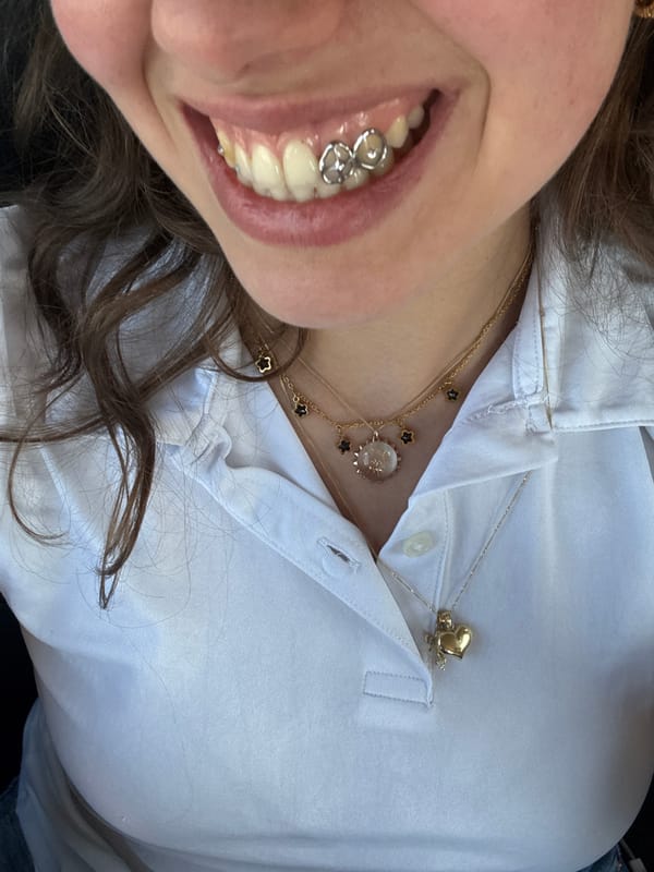 Person in white shirt photographed smiling in Milan
