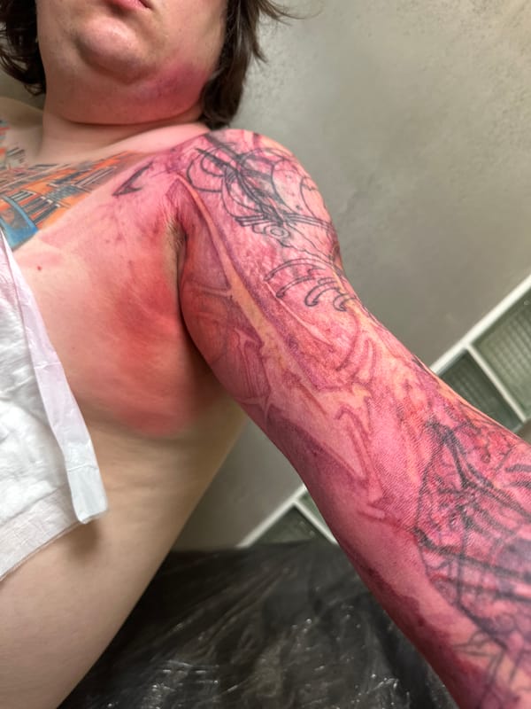 Fresh tattoo work documented in Moscow showing colorful design