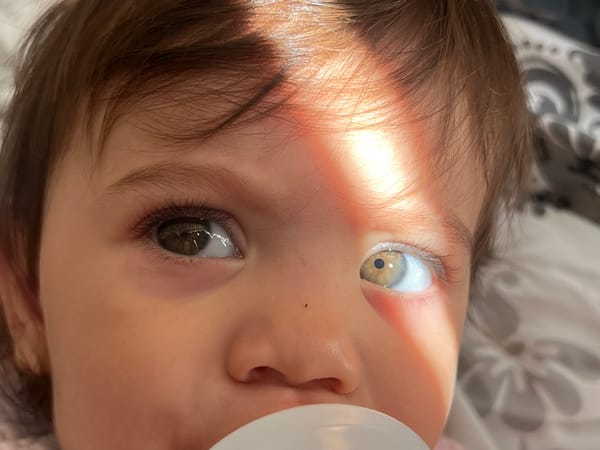 Sunny morning portraits of a baby with heterochromia, Elena, Bulgaria