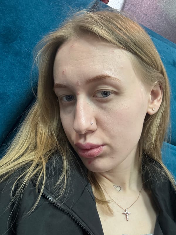 Woman photographed in selfie-style images in Ovoshchnoy, Russia