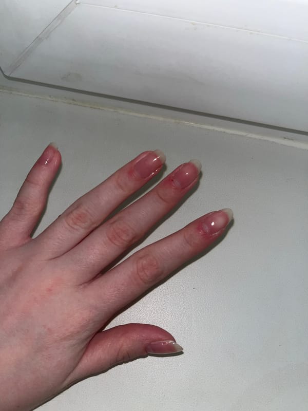 Hand photographed on white surface in Perm
